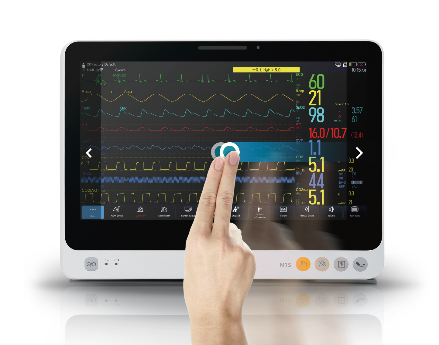 N15 Pre-configured Patient Monitor