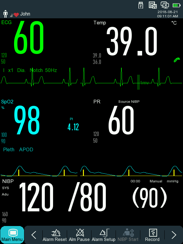 NC5 Vital Signs Monitor