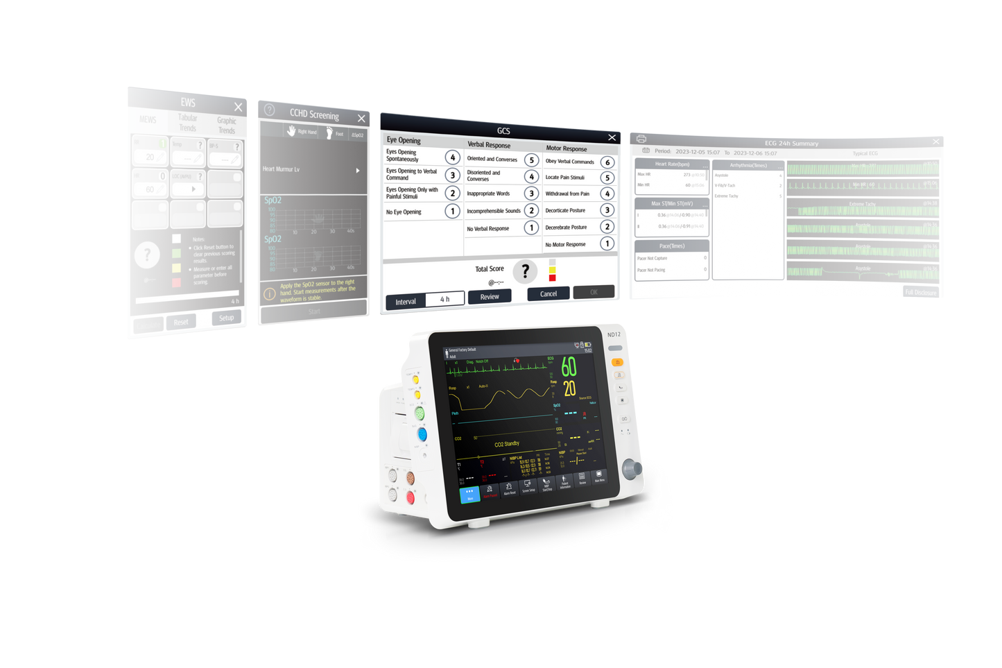 ND10 Patient Monitor