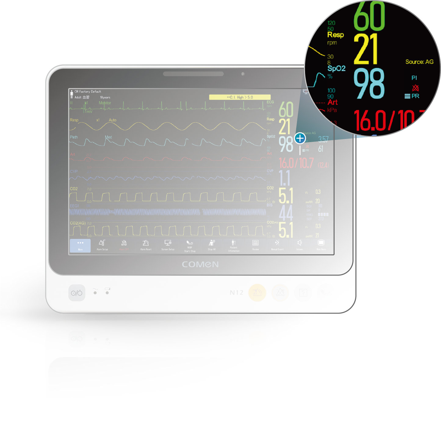 N12-V Veterinary Pre-configured Patient Monitor
